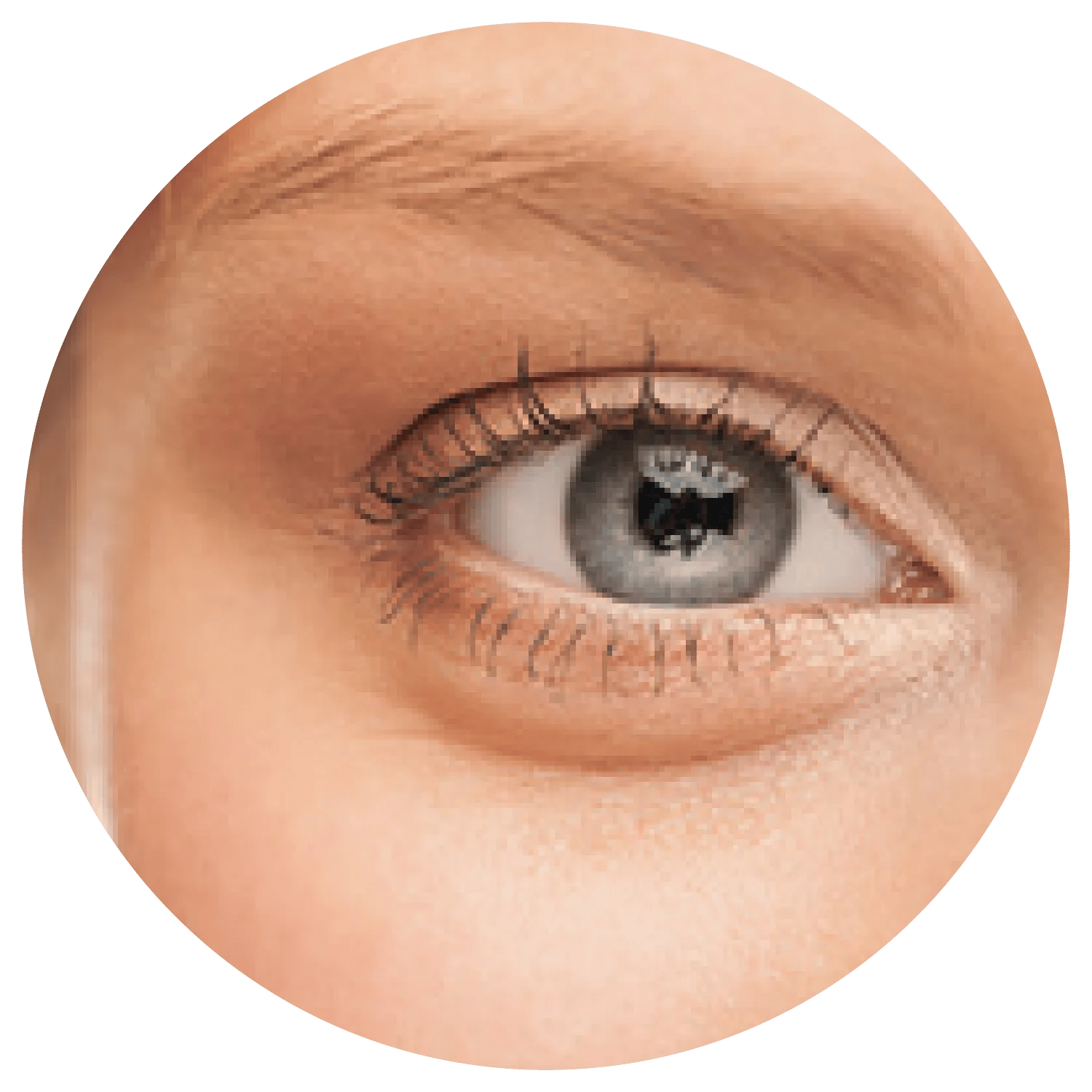 Excessive Eyelid Skin treatment results at Toronto medical spa - The Chain Reaction of Symptoms